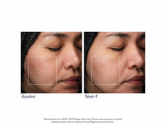 Obagi Retinol + PHA Refining Night Cream