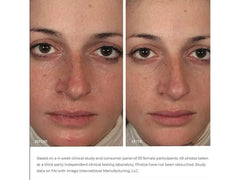 IMAGE Skincare Ormedic Balancing Gel Masque