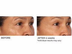 NassifMD® Hydro-Gel with Hyaluronic Acid & Retinol