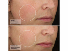 Senté Dermal Repair Ultra-Nourish