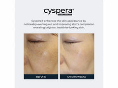 Cyspera Pigment Correction System with Cysteamine Isobionic-Amide Complex