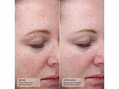 Senté Bio Complete Serum