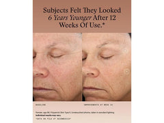 SkinMedica TNS® Advanced+ Serum & Neck Correct Cream Duo