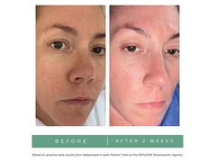 Replenix Pigment Correcting Brightening Cream