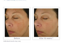 Glytone Enhance Brightening Complex