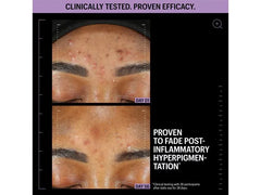 Allies of Skin Azelaic & Kojic Advanced Clarifying Serum