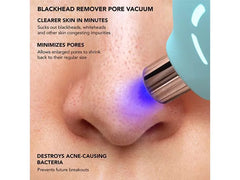 FOREO KIWI™ Blackhead Removal Device