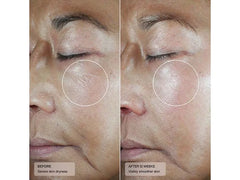 Senté Dermal Repair Ultra-Nourish