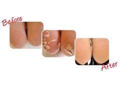 Baby Foot Exfoliation Foot Peel for Men