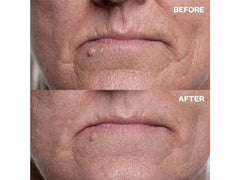 Wrinkles Schminkles Mouth & Lip Wrinkle Smoothing Patches