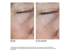 skinbetter science Instant Effect Gel EYE