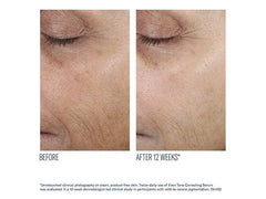 skinbetter science Even Tone Correcting Serum
