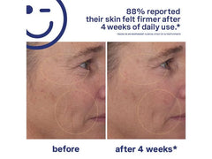 Kate Somerville Skin Transforming Serum