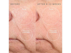 PMD Pro Personal Microderm Device - Taupe