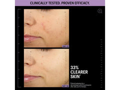 Allies of Skin Azelaic & Kojic Advanced Clarifying Serum