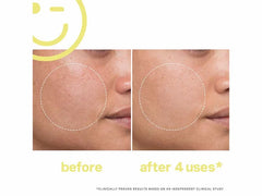 Kate Somerville Mega-C 30% Vitamin C Brightening Facial Mask