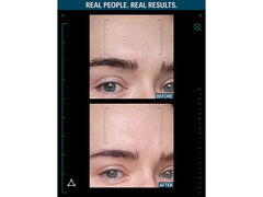Allies of Skin Multi Peptides & GF Advanced Lifting Serum - 1.0 fl oz