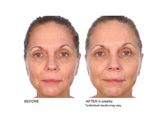 NassifMD® Radiance Brightening Vitamin C Booster Serum