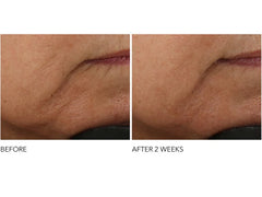 Dr. Dennis Gross Skincare Advanced Retinol + Ferulic Intense Wrinkle Cream