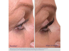 Obagi Nu-Cil™ Eyelash Enhancing Serum