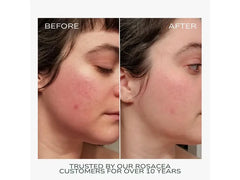 Fitglow Beauty Redness Rescue Cream