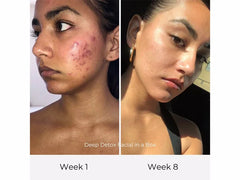 Olga Lorencin Skin Care Deep Detox Facial in a Box