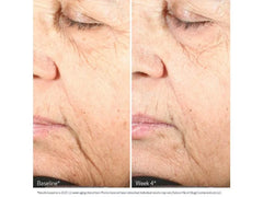 Obagi Nu-Gen Cellular Renewal Serum with NAD+