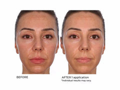 NassifMD® Hydro-Gel with Hyaluronic Acid & Retinol