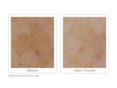 Glytone Enhance Brightening Serum