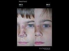Cutagenesis Cutagenix Professional Skin Care Emulsion