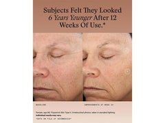SkinMedica Skin Firming Set with TNS Advanced+ Serum