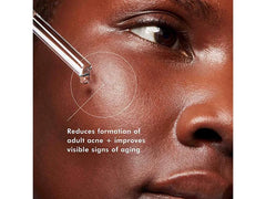 SkinCeuticals Blemish + Age Defense Salicylic Acid Serum