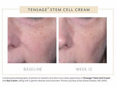 Biopelle Tensage Stem Cell Cream