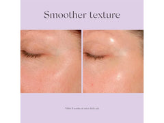 Exuviance Daily Resurfacing Peel CA10