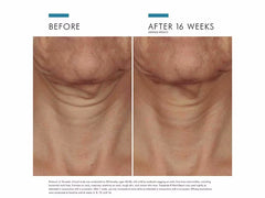 SkinCeuticals Tripeptide-R Retinol Neck Repair Cream