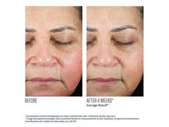 skinbetter science Trio Luxe Moisture Treatment