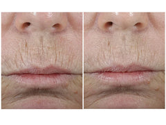 SkinMedica Total Defense + Repair SPF 34 - Untinted