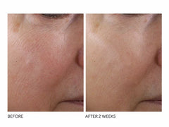 Dr. Dennis Gross Skincare Advanced Retinol + Ferulic Texture Renewal Serum