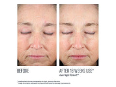 skinbetter science Mystro Revive Renewing Serum