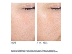 skinbetter science AlphaRet Exfoliating Peel Pads