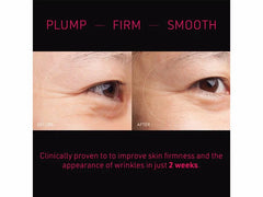 FOREO FAQ Microneedling Anti-Wrinkle Hyaluronic Acid Patches For Under Eyes