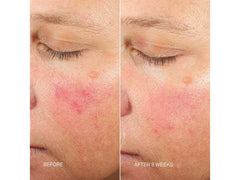 RescueMD Skin Longevity Nighttime Oil