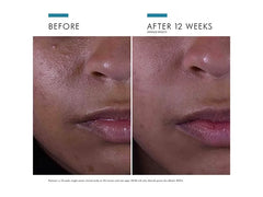 SkinCeuticals Silymarin CF Vitamin C Serum