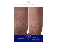 Augustinus Bader The Body Cream - 6.76 fl oz