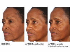 NassifMD® Radiance Brightening Vitamin C Booster Serum