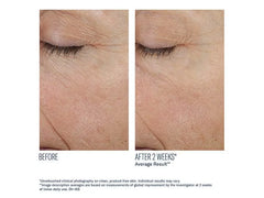 skinbetter science Trio Rebalancing Moisture Treatment