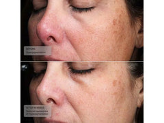 Senté Pigment & Tone Correcting Mask