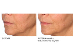 NassifMD® Radiance Brightening Vitamin C Booster Serum