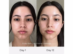 Olga Lorencin Skin Care Red Carpet Facial in a Box
