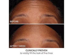 Dr. Dennis Gross Skincare DermInfusions Fill + Repair Serum